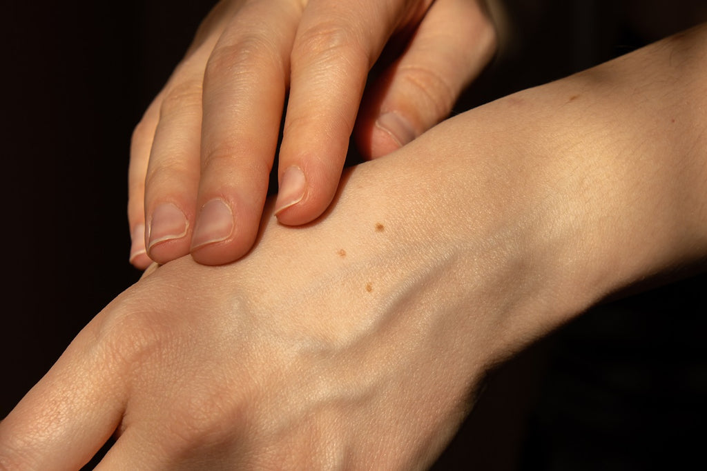 Hypersensibilité de la peau au toucher